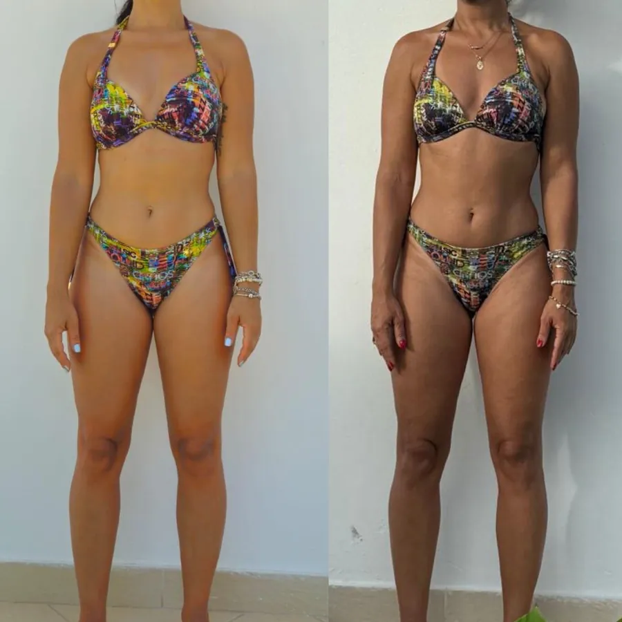 Comparativo visual de paciente em acompanhamento